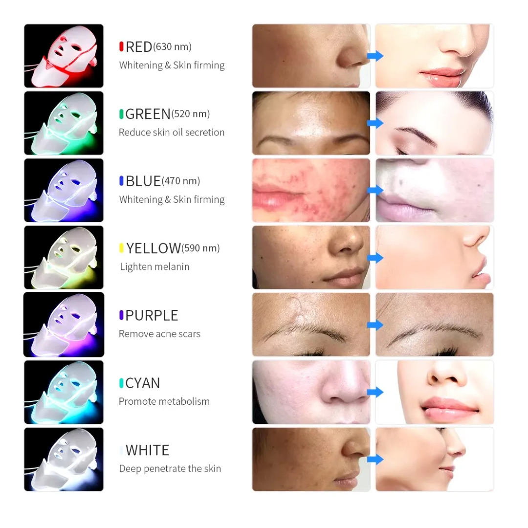 Máscara LED Facial de 7 Colores MIVOH: Tratamiento Profesional Anti-Acné y Anti-Arrugas en Casa
