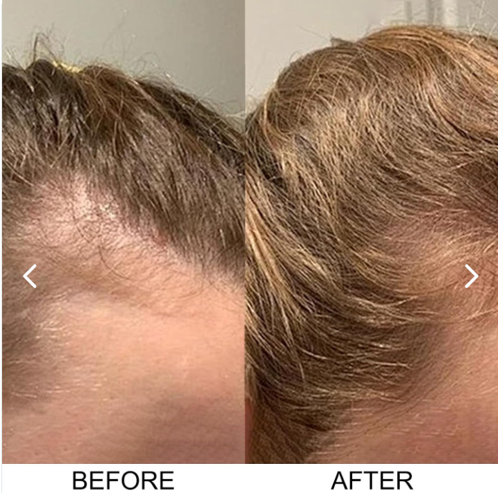 Tónico Capilar Excaltivo 60ml – Estimula el Crecimiento del Cabello