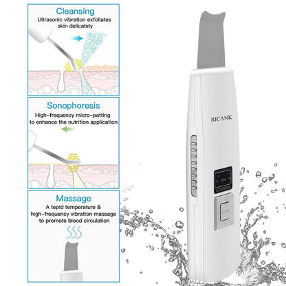 Limpiador Facial Ultrasónico Peeling – Limpieza Profunda - vista alternativa