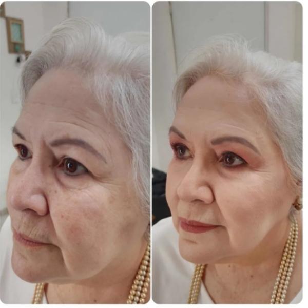 Kit Facial 3 Pasos Niacinamida – Limpieza y Control de Acné - vista lateral